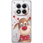 Прозорий чохол BoxFace Xiaomi Redmi Note 15 Pro 5G Winter Deer