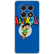 Чохол BoxFace Xiaomi Redmi Note 15 5G 