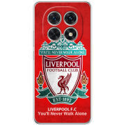 Чохол BoxFace Xiaomi Redmi Note 15 5G 