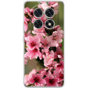 Чохол BoxFace Xiaomi Redmi Note 15 5G Вишневые Цветы