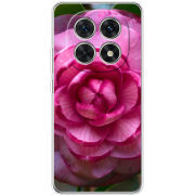 Чохол BoxFace Xiaomi Redmi Note 15 5G 