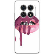 Чохол BoxFace Xiaomi Redmi Note 15 5G 