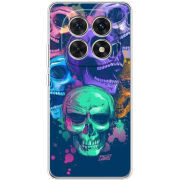 Чохол BoxFace Xiaomi Redmi Note 15 5G 