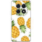 Чохол BoxFace Xiaomi Redmi Note 15 5G 