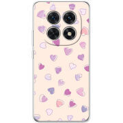 Чохол BoxFace Xiaomi Redmi Note 15 5G 