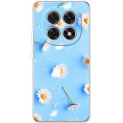 Чохол BoxFace Xiaomi Redmi Note 15 5G 