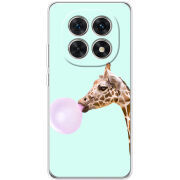 Чохол BoxFace Xiaomi Redmi Note 15 5G 