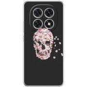 Чохол BoxFace Xiaomi Redmi Note 15 5G 