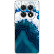 Чохол BoxFace Xiaomi Redmi Note 15 5G 