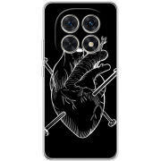 Чохол BoxFace Xiaomi Redmi Note 15 5G 