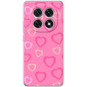 Чохол BoxFace Xiaomi Redmi Note 15 5G Sugar Hearts