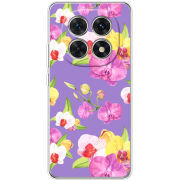 Чохол BoxFace Xiaomi Redmi Note 15 5G 