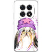 Чохол BoxFace Xiaomi Redmi Note 15 5G 