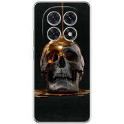 Чохол BoxFace Xiaomi Redmi Note 15 5G 