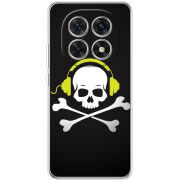 Чохол BoxFace Xiaomi Redmi Note 15 5G 