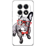 Чохол BoxFace Xiaomi Redmi Note 15 5G 