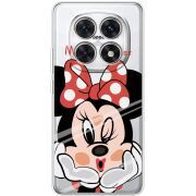 Прозорий чохол BoxFace Xiaomi Redmi Note 15 5G Lady M