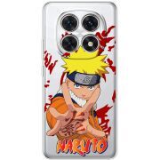 Прозорий чохол BoxFace Xiaomi Redmi Note 15 5G Naruto