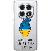 Прозорий чохол BoxFace Xiaomi Redmi Note 15 5G Моє серце в ритмі ЗСУ