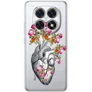 Чохол зі стразами Xiaomi Redmi Note 15 5G Heart