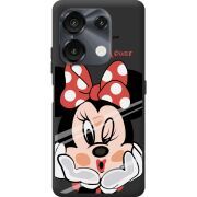 Прозрачный чехол BoxFace Umidigi G9 5G Lady M