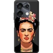 Прозрачный чехол BoxFace Umidigi G9 5G Фрида Кало