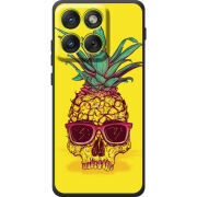 Чохол BoxFace Moto Edge 70 Pineapple Skull