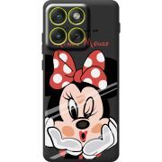 Прозорий чохол BoxFace Moto Edge 70 Lady M