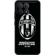 Чохол BoxFace Poco F8 Pro 