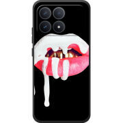 Чохол BoxFace Poco F8 Pro 