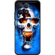 Чохол BoxFace Poco F8 Pro 