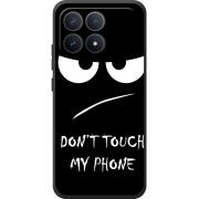 Чохол BoxFace Poco F8 Pro Don't Touch my Phone
