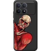 Прозорий чохол BoxFace Poco F8 Pro Титан