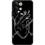 Чохол BoxFace Realme C85 