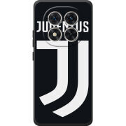 Чохол BoxFace Xiaomi Redmi Note 15 Pro FC J