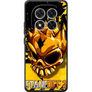 Чохол BoxFace Xiaomi Redmi Note 15 Pro StandOff 2 gold