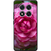 Чохол BoxFace Xiaomi Redmi Note 15 Pro 