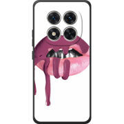 Чохол BoxFace Xiaomi Redmi Note 15 Pro 