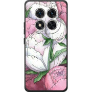 Чохол BoxFace Xiaomi Redmi Note 15 Pro 