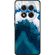 Чохол BoxFace Xiaomi Redmi Note 15 Pro 