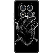 Чохол BoxFace Xiaomi Redmi Note 15 Pro 