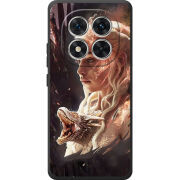 Чохол BoxFace Xiaomi Redmi Note 15 Pro 