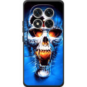 Чохол BoxFace Xiaomi Redmi Note 15 Pro 