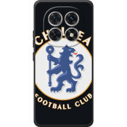 Чохол BoxFace Poco M8 FC Chelsea