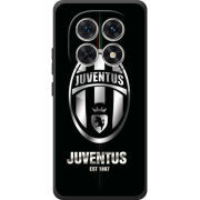 Чохол BoxFace Poco M8 