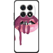 Чохол BoxFace Poco M8 