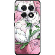 Чохол BoxFace Poco M8 