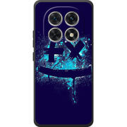 Чохол BoxFace Poco M8 