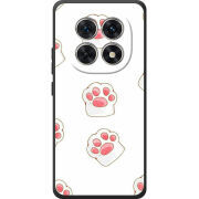 Чохол BoxFace Poco M8 