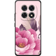 Чохол BoxFace Poco M8 